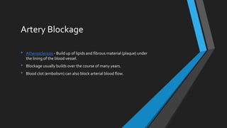 Artery Blockage
• Atherosclerosis - Build up of lipids and fibrous material (plaque) under
the lining of the blood vessel.
• Blockage usually builds over the course of many years.
• Blood clot (embolism) can also block arterial blood flow.
 