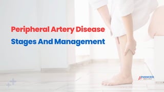 Peripheral Artery Disease Stages And Management.pdf