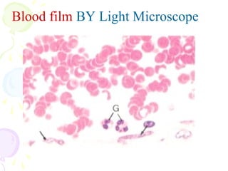 Blood film BY Light Microscope
 