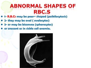 •   1- R.B.Cs may be pear– shaped (poikilocytosis)
•   2- they may be oval ( ovalocytes)
•   3- or may be biconvex (spherocytes)
•   or crescent as in sickle cell anemia.
 