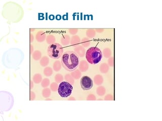 Blood film
 