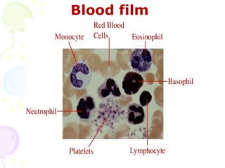 Blood film
 