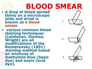 • A drop of blood spread
  thinly on a microscope
  slide and dried is
  known as a blood
  smear.
• various common blood
  staining techniques
  (Leishman, Giemsa,
  Wright) are all
  modifications of the
  Romanovsky (1891)
  staining method based
  on mixtures of
  methylene blue (basic
  dye) and eosin (acid
  dye).
 