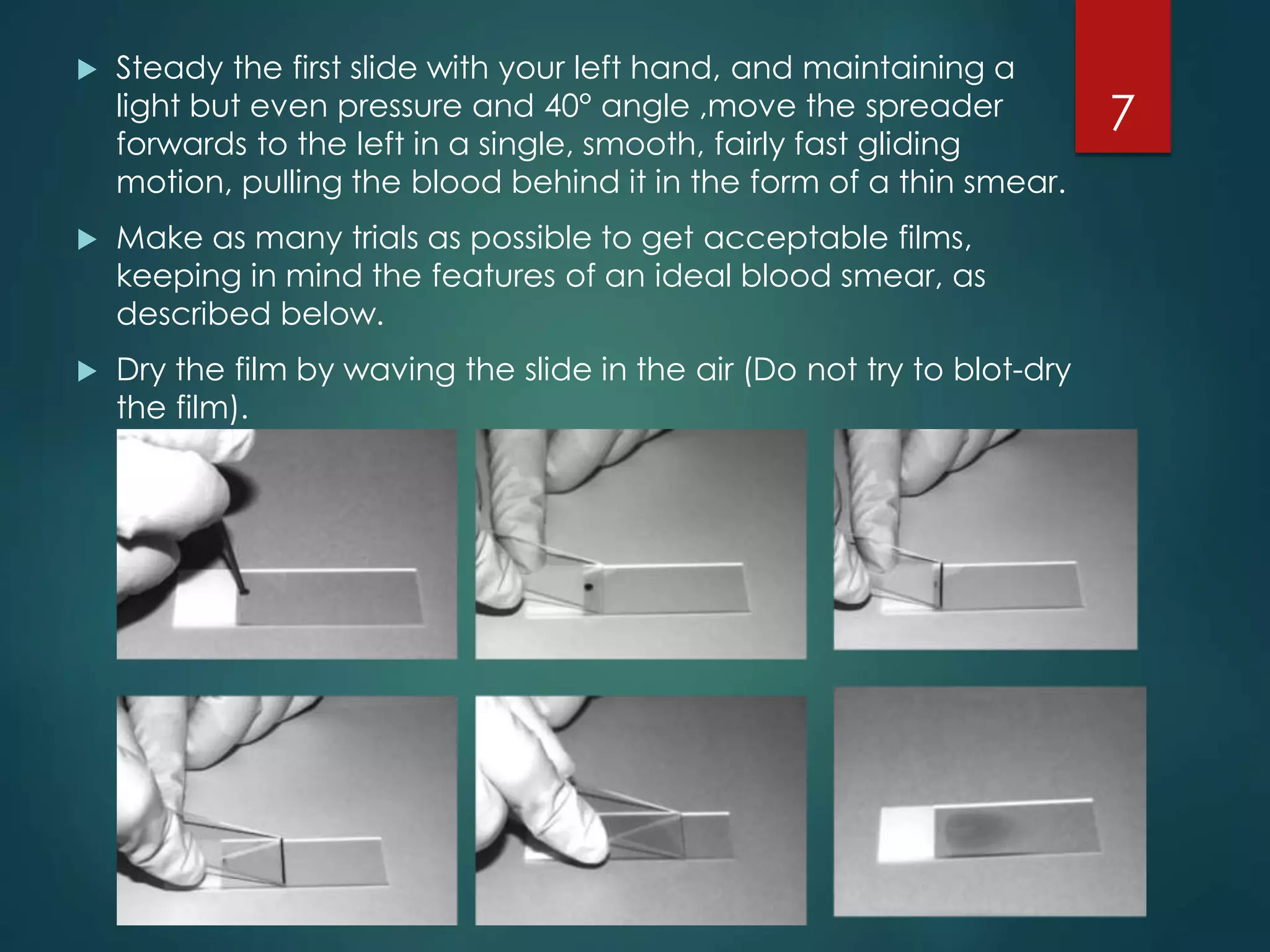 Peripheral Blood Smear | PPTX