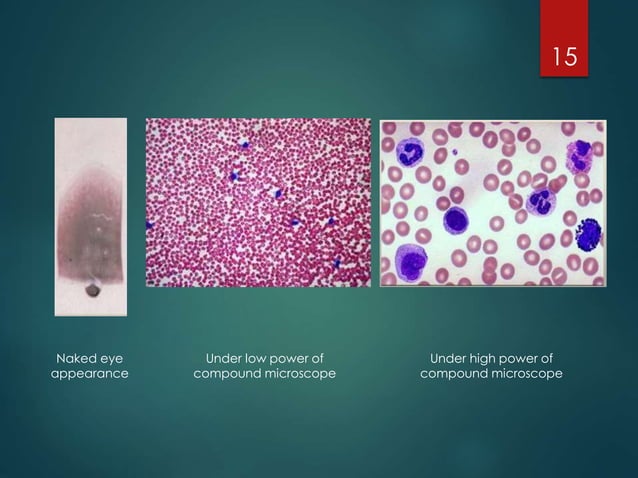 Peripheral Blood Smear | PPTX