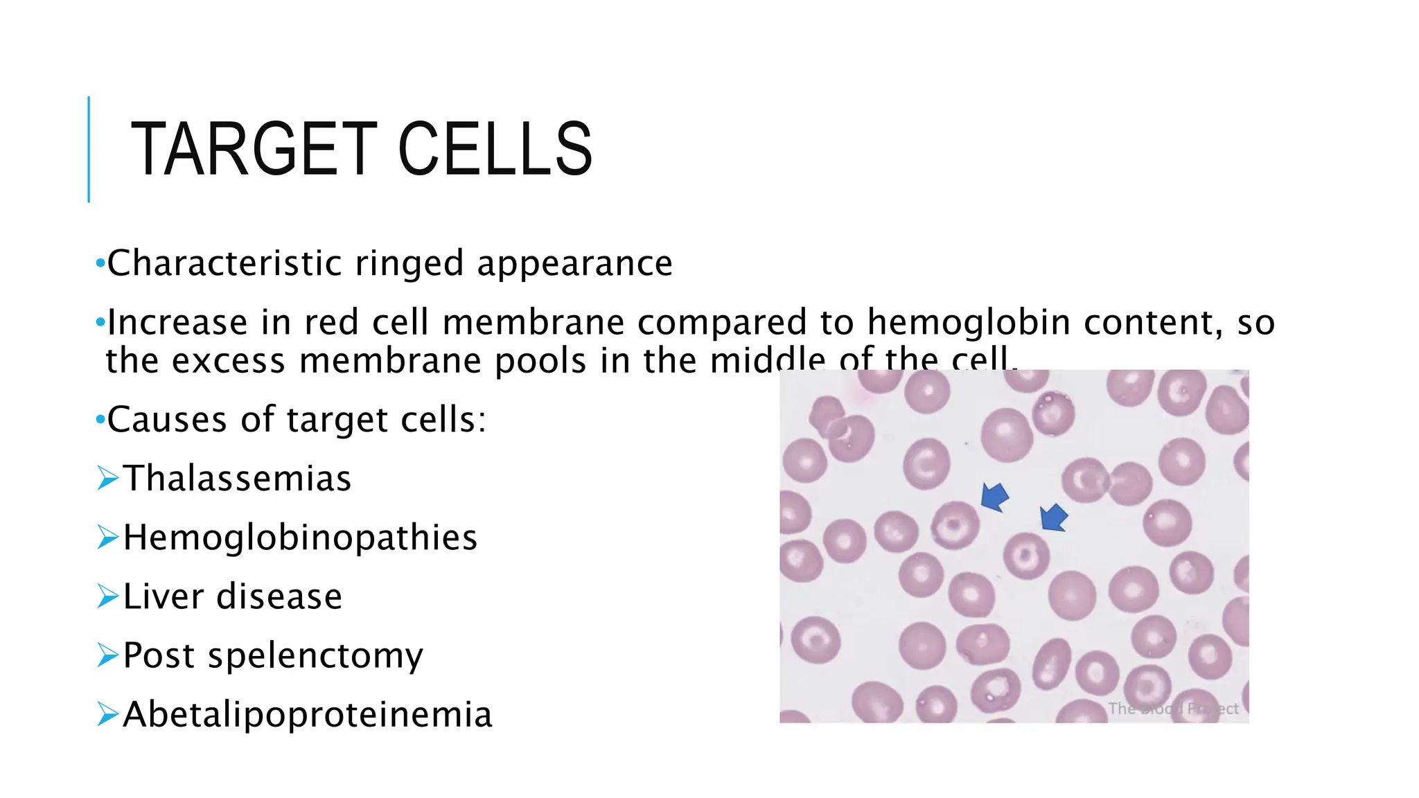 PERIPHERAL BLOOD SMEAR examinationn.pptx