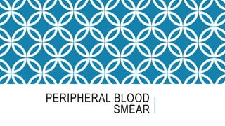 PERIPHERAL BLOOD
SMEAR
 