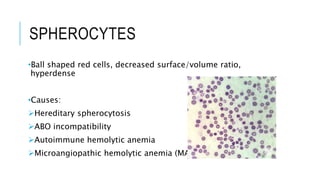 SPHEROCYTES
•Ball shaped red cells, decreased surface/volume ratio,
hyperdense
•Causes:
Hereditary spherocytosis
ABO incompatibility
Autoimmune hemolytic anemia
Microangiopathic hemolytic anemia (MAHA)
 