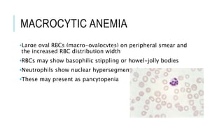 MACROCYTIC ANEMIA
•Large oval RBCs (macro-ovalocytes) on peripheral smear and
the increased RBC distribution width
•RBCs may show basophilic stippling or howel-jolly bodies
•Neutrophils show nuclear hypersegmentation
•These may present as pancytopenia
 