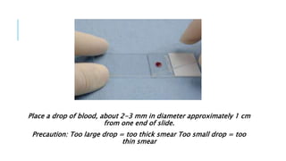 Place a drop of blood, about 2-3 mm in diameter approximately 1 cm
from one end of slide.
Precaution: Too large drop = too thick smear Too small drop = too
thin smear
 