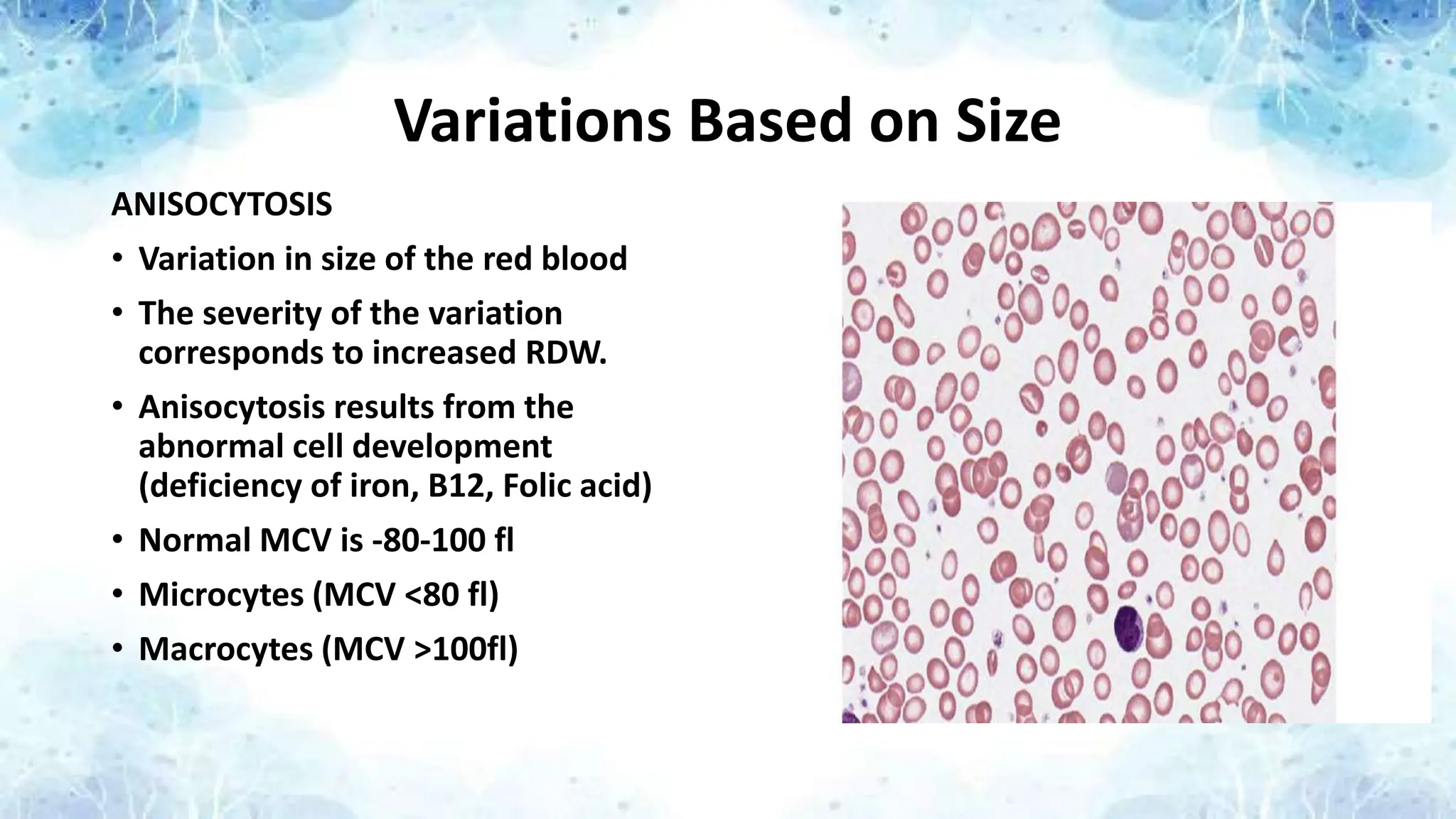 Variations Based on Size
ANISOCYTOSIS
• Variation in size of the red blood
• The severity of the variation
corresponds to increased RDW.
• Anisocytosis results from the
abnormal cell development
(deficiency of iron, B12, Folic acid)
• Normal MCV is -80-100 fl
• Microcytes (MCV <80 fl)
• Macrocytes (MCV >100fl)
 