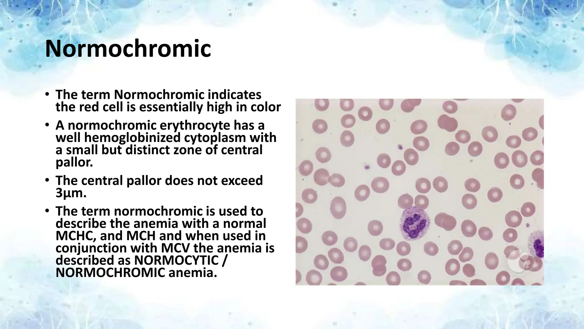Normochromic
• The term Normochromic indicates
the red cell is essentially high in color
• A normochromic erythrocyte has a
well hemoglobinized cytoplasm with
a small but distinct zone of central
pallor.
• The central pallor does not exceed
3μm.
• The term normochromic is used to
describe the anemia with a normal
MCHC, and MCH and when used in
conjunction with MCV the anemia is
described as NORMOCYTIC /
NORMOCHROMIC anemia.
 