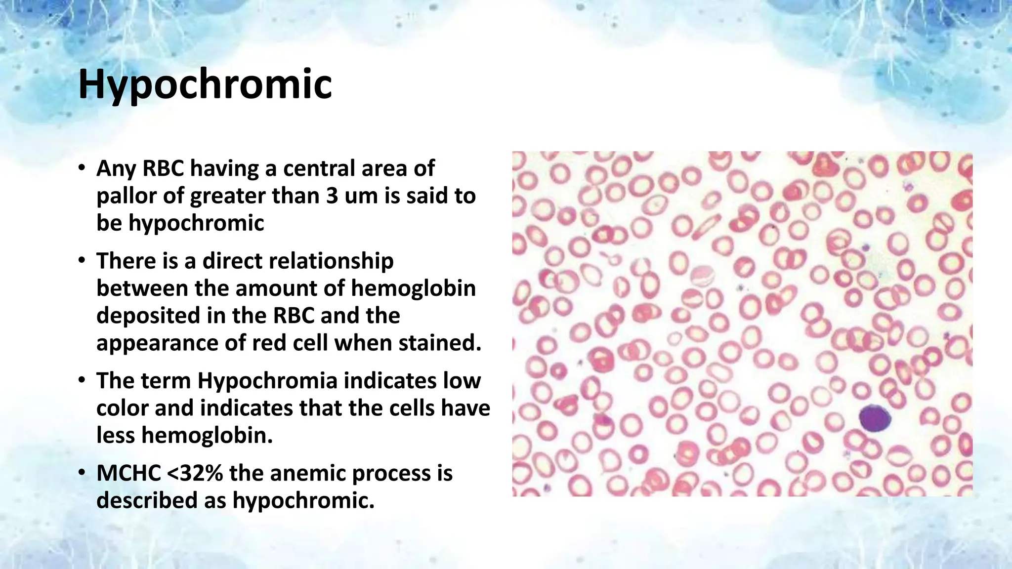 Hypochromic
• Any RBC having a central area of
pallor of greater than 3 um is said to
be hypochromic
• There is a direct relationship
between the amount of hemoglobin
deposited in the RBC and the
appearance of red cell when stained.
• The term Hypochromia indicates low
color and indicates that the cells have
less hemoglobin.
• MCHC <32% the anemic process is
described as hypochromic.
 