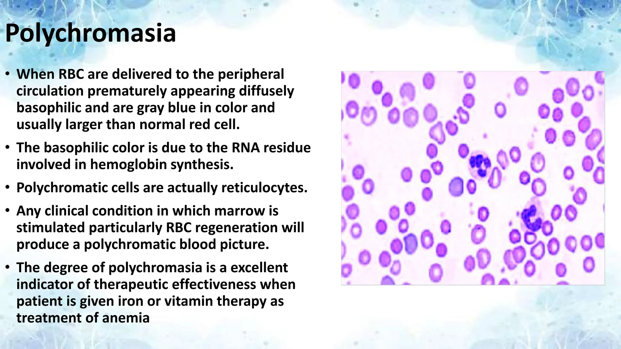 Polychromasia
• When RBC are delivered to the peripheral
circulation prematurely appearing diffusely
basophilic and are gray blue in color and
usually larger than normal red cell.
• The basophilic color is due to the RNA residue
involved in hemoglobin synthesis.
• Polychromatic cells are actually reticulocytes.
• Any clinical condition in which marrow is
stimulated particularly RBC regeneration will
produce a polychromatic blood picture.
• The degree of polychromasia is a excellent
indicator of therapeutic effectiveness when
patient is given iron or vitamin therapy as
treatment of anemia
 