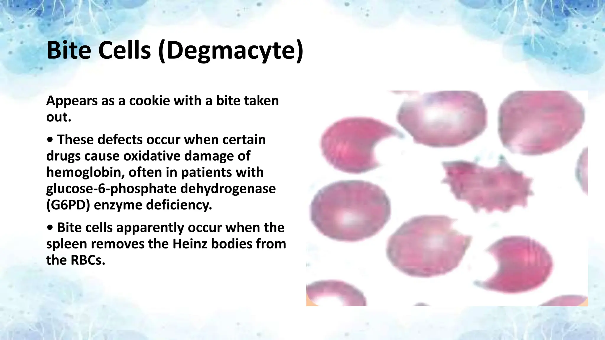 Bite Cells (Degmacyte)
Appears as a cookie with a bite taken
out.
• These defects occur when certain
drugs cause oxidative damage of
hemoglobin, often in patients with
glucose-6-phosphate dehydrogenase
(G6PD) enzyme deficiency.
• Bite cells apparently occur when the
spleen removes the Heinz bodies from
the RBCs.
 