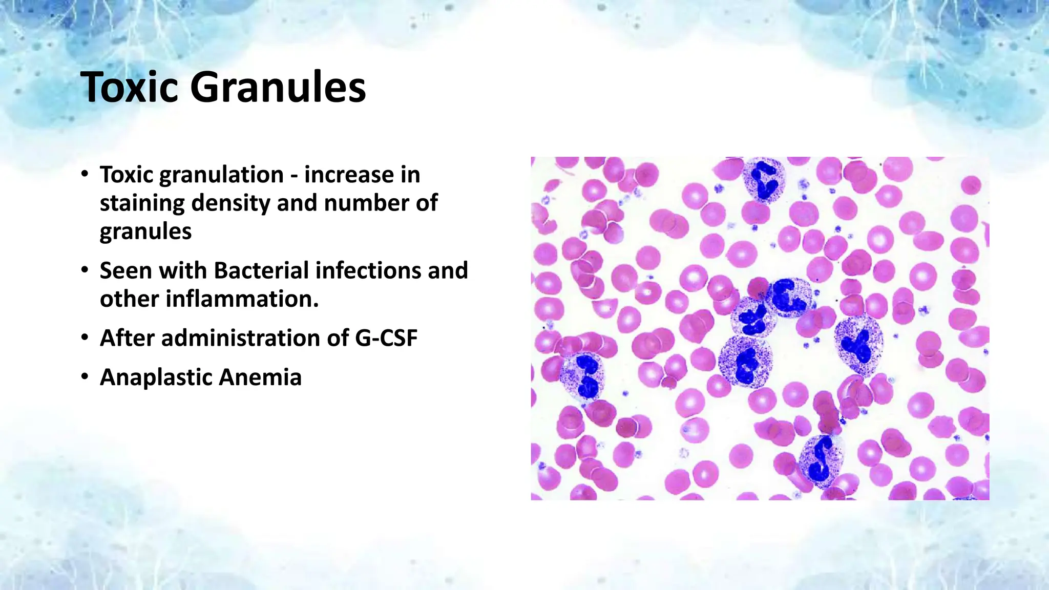 Toxic Granules
• Toxic granulation - increase in
staining density and number of
granules
• Seen with Bacterial infections and
other inflammation.
• After administration of G-CSF
• Anaplastic Anemia
 