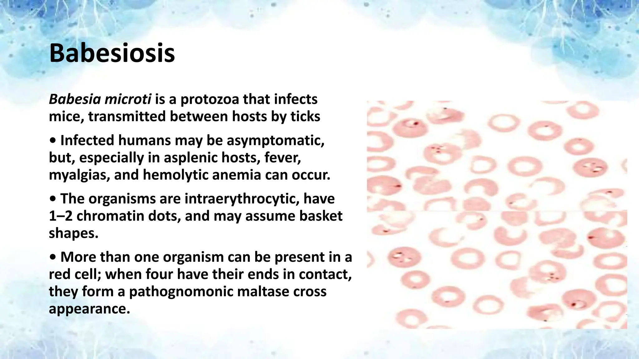 Babesiosis
Babesia microti is a protozoa that infects
mice, transmitted between hosts by ticks
• Infected humans may be asymptomatic,
but, especially in asplenic hosts, fever,
myalgias, and hemolytic anemia can occur.
• The organisms are intraerythrocytic, have
1–2 chromatin dots, and may assume basket
shapes.
• More than one organism can be present in a
red cell; when four have their ends in contact,
they form a pathognomonic maltase cross
appearance.
 