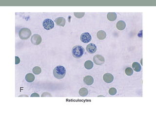 Peripheral Blood SMear-piyabi pathology .pptx