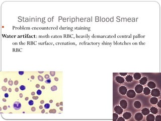 Mild Crenation Rbc Peripheral Blood Smear - staining with various methods.pptx
