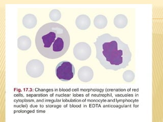 peripheral blood smear (2).pptx rbc wbc pla | PPTX