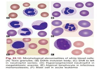 peripheral blood smear (2).pptx rbc wbc pla | PPTX