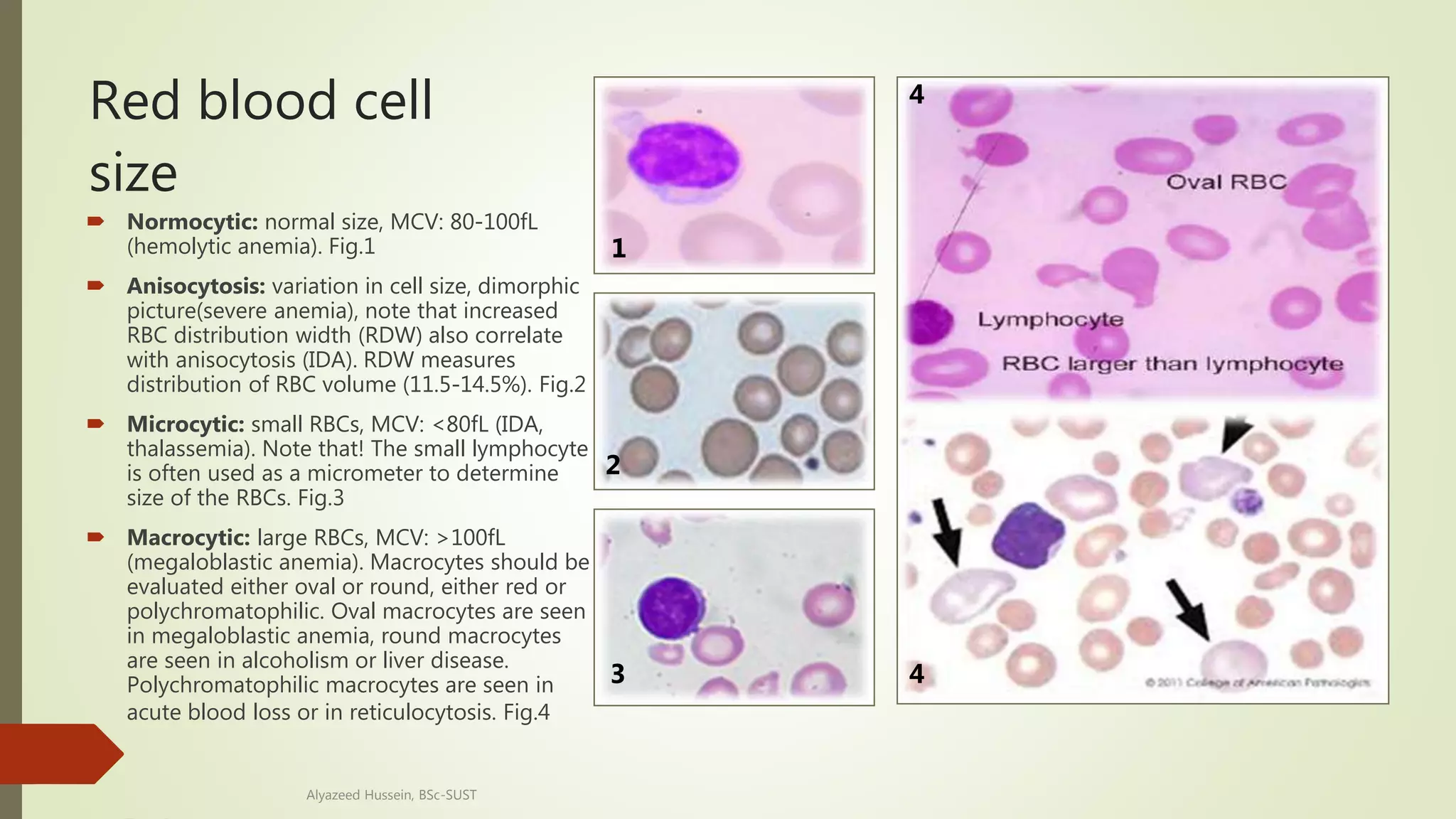 Peripheral blood smear 2020 | PPTX