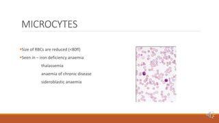Peripheral blood smear [autosaved] | PPTX