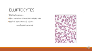 Peripheral blood smear [autosaved] | PPTX