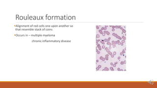 Peripheral blood smear [autosaved] | PPTX