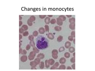 Changes in monocytes
 