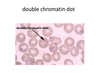 double chromatin dot
 