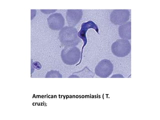 American trypanosomiasis ( T.
cruzi);
 