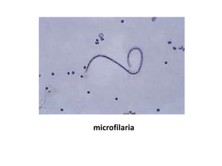 microfilaria
 