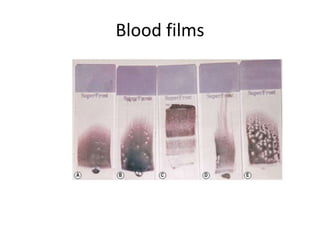 Blood films
 