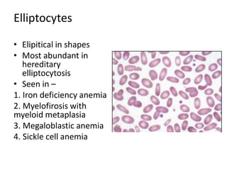 Elliptocytes
• Elipitical in shapes
• Most abundant in
hereditary
elliptocytosis
• Seen in –
1. Iron deficiency anemia
2. Myelofirosis with
myeloid metaplasia
3. Megaloblastic anemia
4. Sickle cell anemia
 