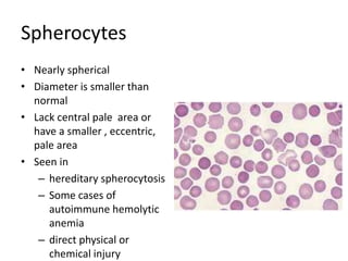 Spherocytes
• Nearly spherical
• Diameter is smaller than
normal
• Lack central pale area or
have a smaller , eccentric,
pale area
• Seen in
– hereditary spherocytosis
– Some cases of
autoimmune hemolytic
anemia
– direct physical or
chemical injury
 