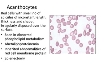 Acanthocytes
Red cells with small no of
spicules of inconstant length,
thickness and shape ,
irregularly disposed over the
surface.
• Seen in Abnormal
phospholipid metabolism
• Abetalipoproteinemia
• Inherited abnormalities of
red cell membrane protein
• Splenectomy
 