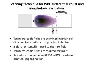 • Ten microscopic fields are examined in a vertical
direction from bottom to top or top to bottom
• Slide is horizontally moved to the next field
• Ten microscopic fields are counted vertically.
• Procedure is repeated until 100 WBCS have been
counted (zig zag motion)
Scanning technique for WBC differential count and
morphologic evaluation
 