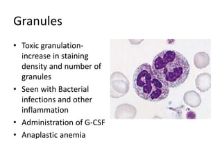 Granules
• Toxic granulation-
increase in staining
density and number of
granules
• Seen with Bacterial
infections and other
inflammation
• Administration of G-CSF
• Anaplastic anemia
 