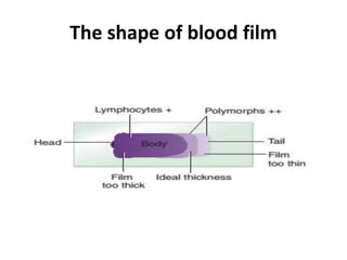 The shape of blood film
 