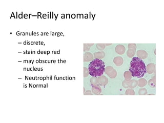 Alder–Reilly anomaly
• Granules are large,
– discrete,
– stain deep red
– may obscure the
nucleus
– Neutrophil function
is Normal
 