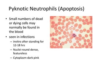 Pyknotic Neutrophils (Apoptosis)
• Small numbers of dead
or dying cells may
normally be found in
the blood
• seen in infections
– invitro after standing for
12-18 hrs
– Nuclei-round dense,
featureless
– Cytoplasm-dark pink
 