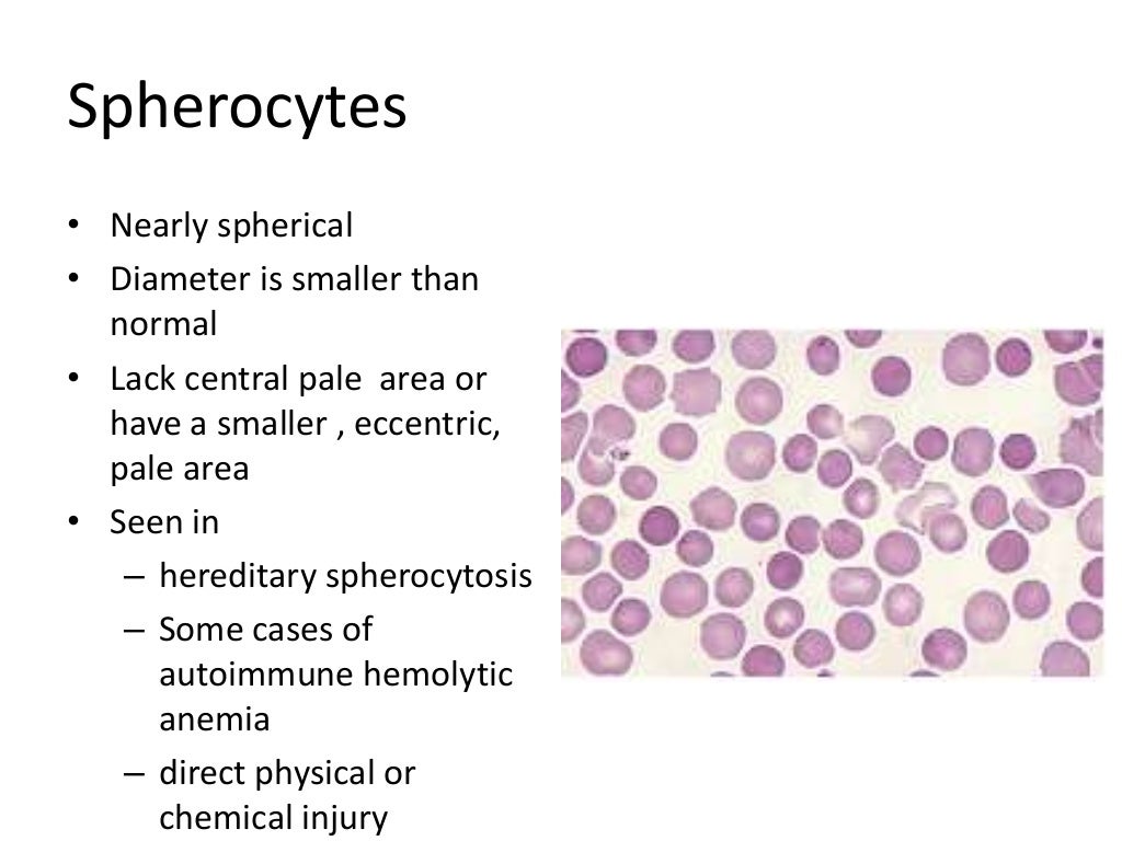 Peripheral blood smear examination