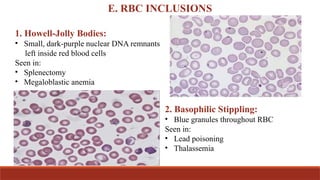 PERIPHERAL BLOOD SMEAR OBSERVATIONS.pptx