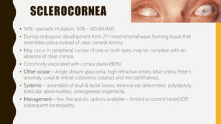 SCLEROCORNEA
• 50% -sporadic mutation, 50% - AD/AR/XLD
• During embryonic development from 2nd mesenchymal wave forming tissue that
resembles sclera instead of clear corneal stroma
• May occur in peripheral cornea of one or both eyes, may be complete with an
absence of clear cornea.
• Commonly associated with cornea plana (80%)
• Other ocular – Angle closure glaucoma, high refractive errors, blue sclera, Peter’s
anomaly, uveal & retinal coloboma, cataract and microphthalmos.
• Systemic – anomalies of skull & facial bones, external ear deformities, polydactyly,
testicular abnormalities, osteogenesis imperfecta.
• Management – few therapeutic options available – limited to control raised IOP,
subsequent keratopalsty.
 