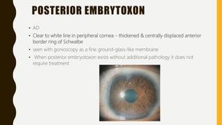 POSTERIOR EMBRYTOXON
• AD
• Clear to white line in peripheral cornea – thickened & centrally displaced anterior
border ring of Schwalbe
• seen with gonioscopy as a fine ground-glass-like membrane
• When posterior embryotoxon exists without additional pathology it does not
require treatment
 