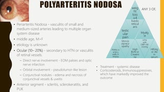 POLYARTERITIS NODOSA
• Periarteritis Nodosa - vasculitis of small and
medium-sized arteries leading to multiple organ
system disease
• middle age, M>F
• etiology is unknown
• Ocular (10– 20%) - secondary to HTN or vasculitis
of retinal vessels.
– Direct nerve involvement - EOM palsies and optic
nerve infarction
– Orbital involvement - pseudotumor-like lesion
– Conjunctival nodules - edema and necrosis of
conjunctival vessels & uveitis
• Anterior segment - scleritis, sclerokeratitis, and
PUK
weig
ht
loss
≥4
kg
testic
ular
pain
livedo
reticul
aris
Myalg
ia
PMNs in
artery
walls in
biopsy
Mon/p
olyneur
opathy
High
BUN or
Creatini
ne
HTN
with
DBP>90
mmHg
HBSAg
or Ab
in
serum
• Treatment - systemic disease
• Corticosteroids, Immunosuppressives,
which have markedly improved the
outcome
ANY 3 OF,
 
