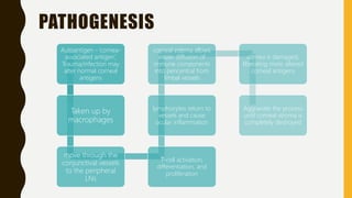 Autoantigen - ‘cornea-
associated antigen’,
Trauma/infection may
alter normal corneal
antigens
Taken up by
macrophages
move through the
conjunctival vessels
to the peripheral
LNs
T-cell activation,
differentiation, and
proliferation
lymphocytes return to
vessels and cause
ocular inflammation
corneal edema allows
easier diffusion of
immune components
into pericentral from
limbal vessels
cornea is damaged,
liberating more altered
corneal antigens
Aggravate the process
until corneal stroma is
completely destroyed
PATHOGENESIS
 