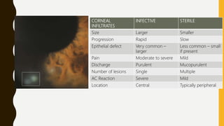 CORNEAL
INFILTRATES
INFECTIVE STERILE
Size Larger Smaller
Progression Rapid Slow
Epithelial defect Very common –
larger
Less common – small
if present
Pain Moderate to severe Mild
Discharge Purulent Mucopurulent
Number of lesions Single Multiple
AC Reaction Severe Mild
Location Central Typically peripheral
 