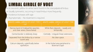 LIMBAL GIRDLE OF VOGT
• A crescentic yellow-to-white band found in the interpalpebral limbus
• Usually symmetric, occurring in nasal limbus more frequently
• Incidence increases with age
• Asymptomatic - No treatment is required.
WHITE LIMBAL GIRDLE OF VOGT TYPE I
– b/l
WHITE LIMBAL GIRDLE OF VOGT TYPE
II
Narrow band of chalkywhite opacities
and clear areas (Swisscheese)
White fleck deposits - nasally and
temporally
Central border is relatively sharp Centrally - irregular linear extensions
Separated from the limbus by a narrow
lucent area
No clear space
Calcium deposits, superficially below
epithelium
In the limbal area peripheral to
Bowman’s layer
 